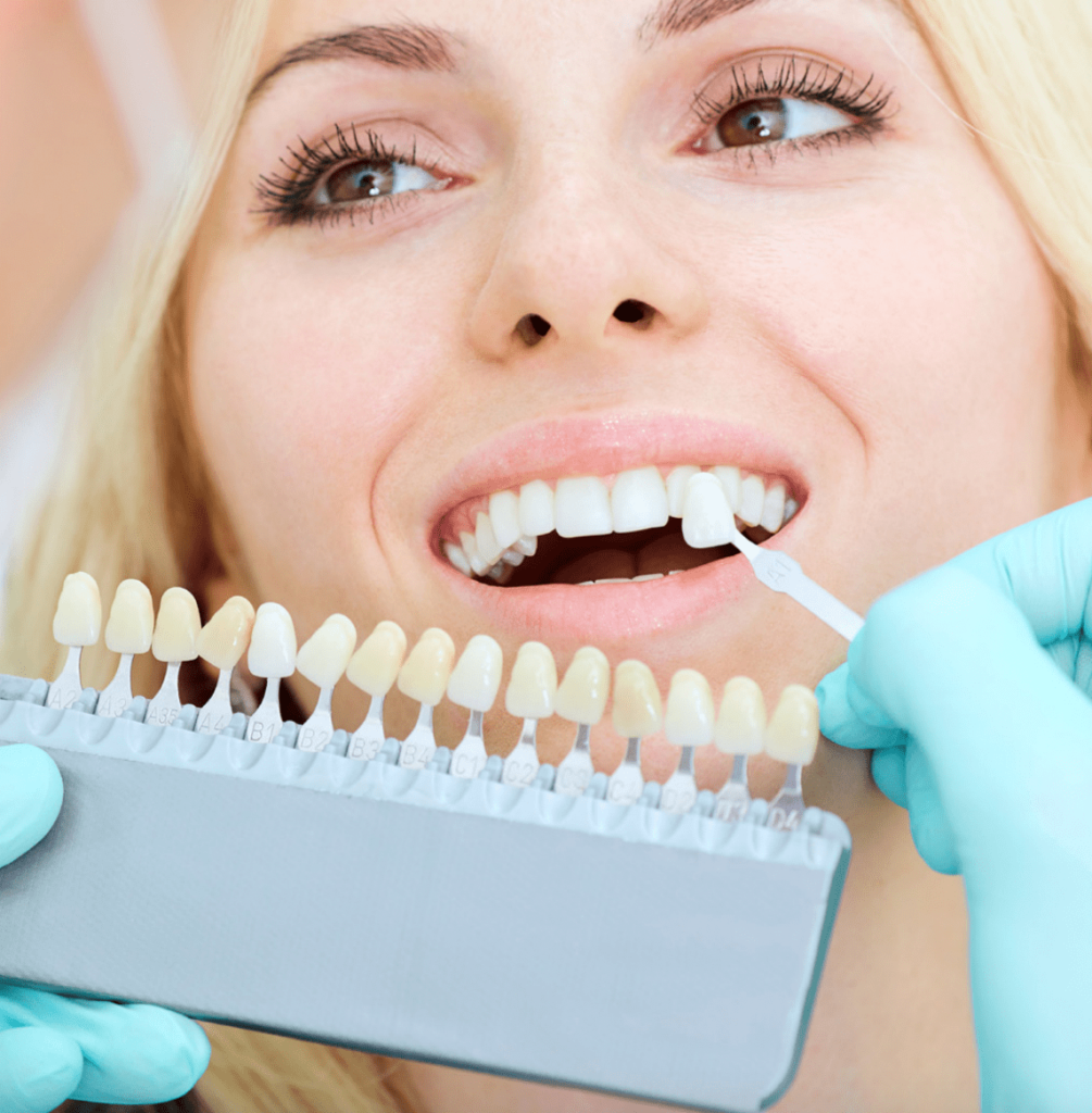 Cosmetic Dentistry Veneers Teeth Whitening